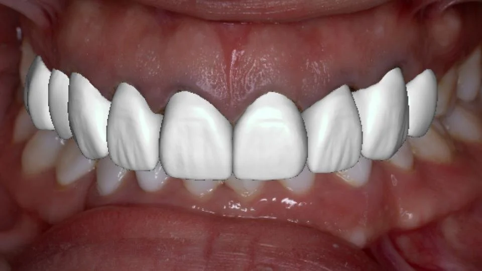 Diagnostic Treatment Services — 38 Smiles Dental Laboratory